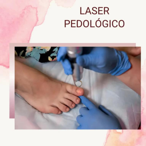 Laser Podológico